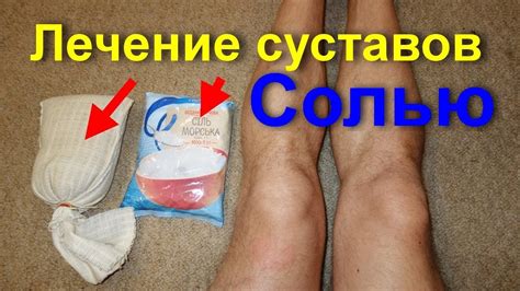 лечение на артроза с кал в Крим